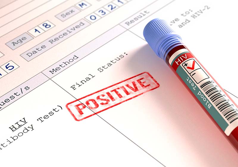 About HIV